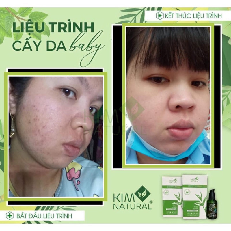 TINH CHẤT TRÀ XANH THƯỜNG KIMNATURAL