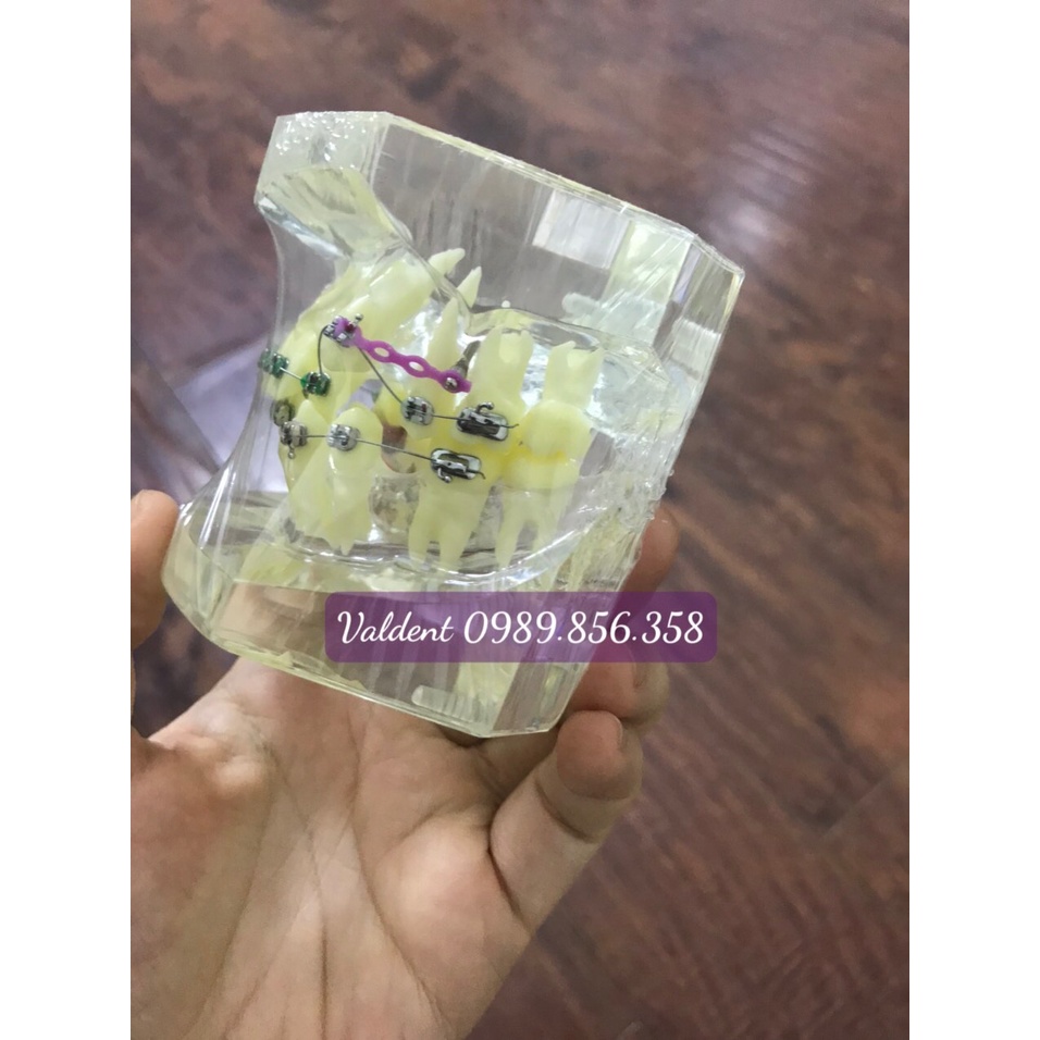 MÔ HÌNH HÀM TƯ VẤN CHỈNH NHA NHA KHOA - MÔ HÌNH TƯ VẤN NHA KHOA