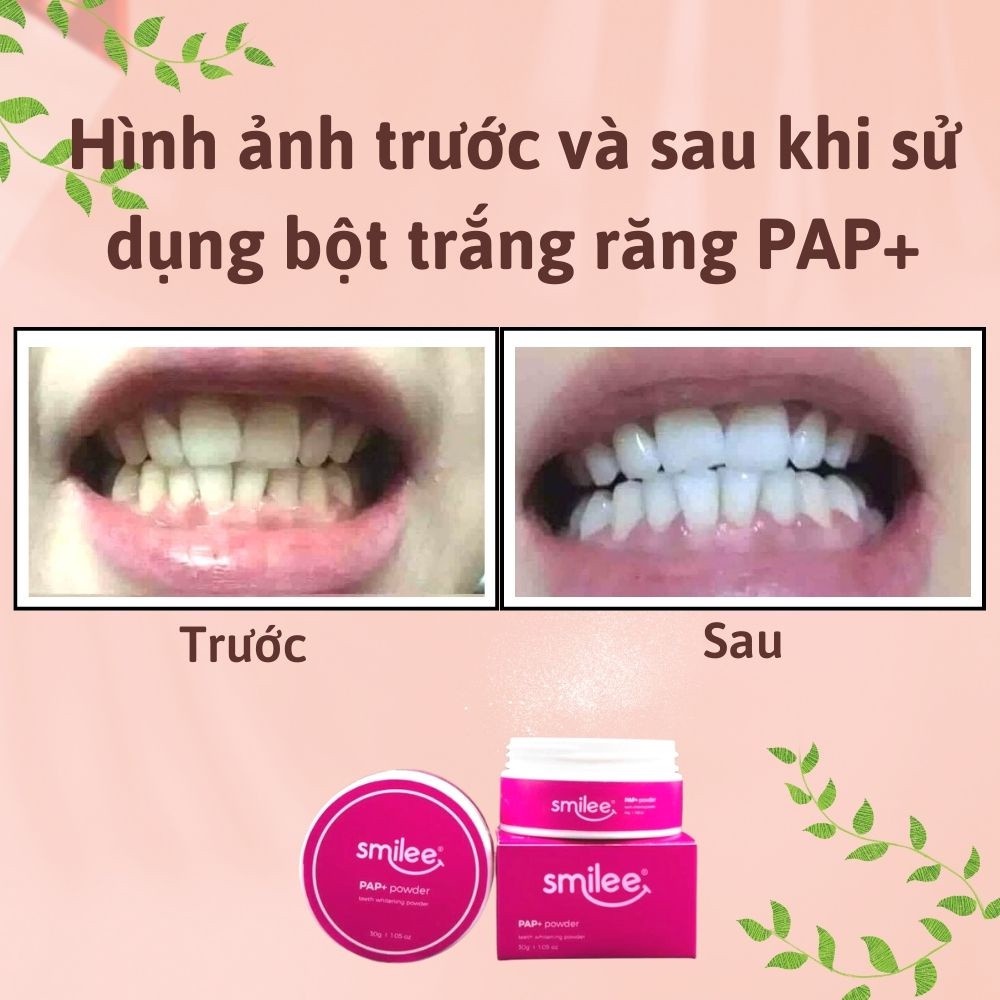 (Hàng tặng không bán) Bột trắng răng công nghệ PAP+ làm trắng hiệu quả