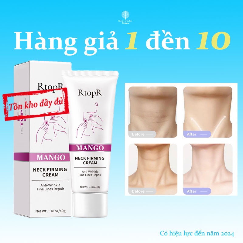 Kem cổ xoài giữ ẩm RtopR,Những nếp nhăn trên cổ,Nâng cao nếp nhăn, xoa bóp, chăm sóc cổ, làm mờ nếp nhăn ở cổ,40ml