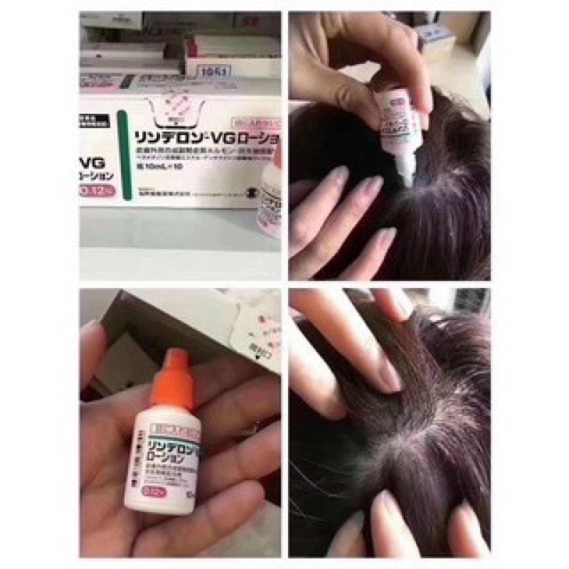 Kem Bôi Giảm Nấm Ngứa Rinderon VG 5gr & 10ml