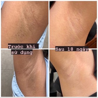 [ Kem dưỡng sáng da nách ] Extra White & Deodorant - Rucos