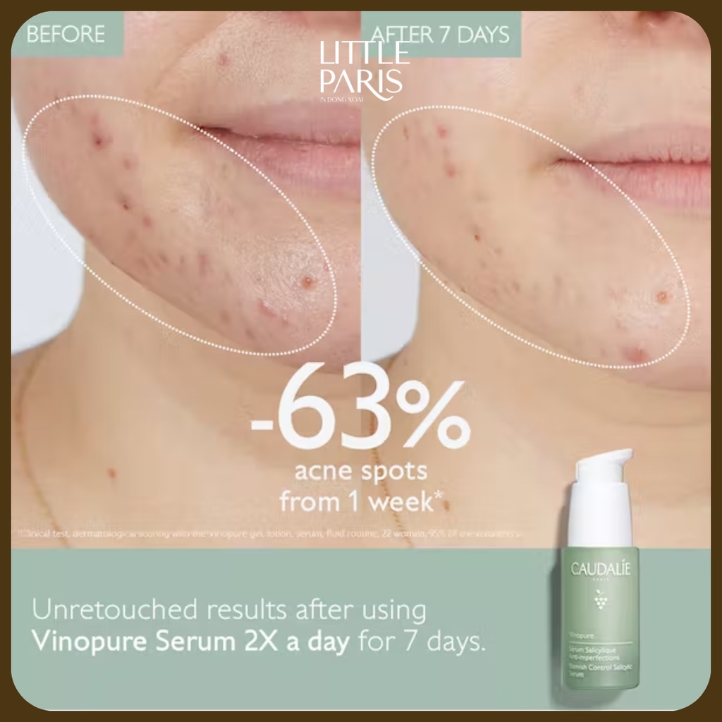 Tinh Chất Dưỡng Da Mụn Caudalie Vinopure Skin Perfecting Salicylic Serum 30ml