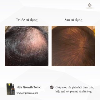 TINH CHẤT MỌC TÓC, LÀM PHỒNG CHÂN TÓC 𝐈𝐍𝐒𝐏𝐈𝐑𝐄 𝐇𝐀𝐈𝐑 𝐆𝐑𝐎𝐖𝐓𝐇 𝐓𝐎𝐍𝐈𝐂