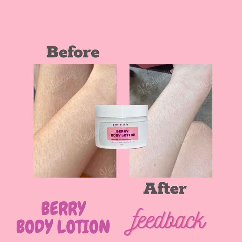 Kem dưỡng body Berry Body Lotion | KATIEBEAUTY