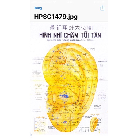 Hình nhĩ châm & tài liệu