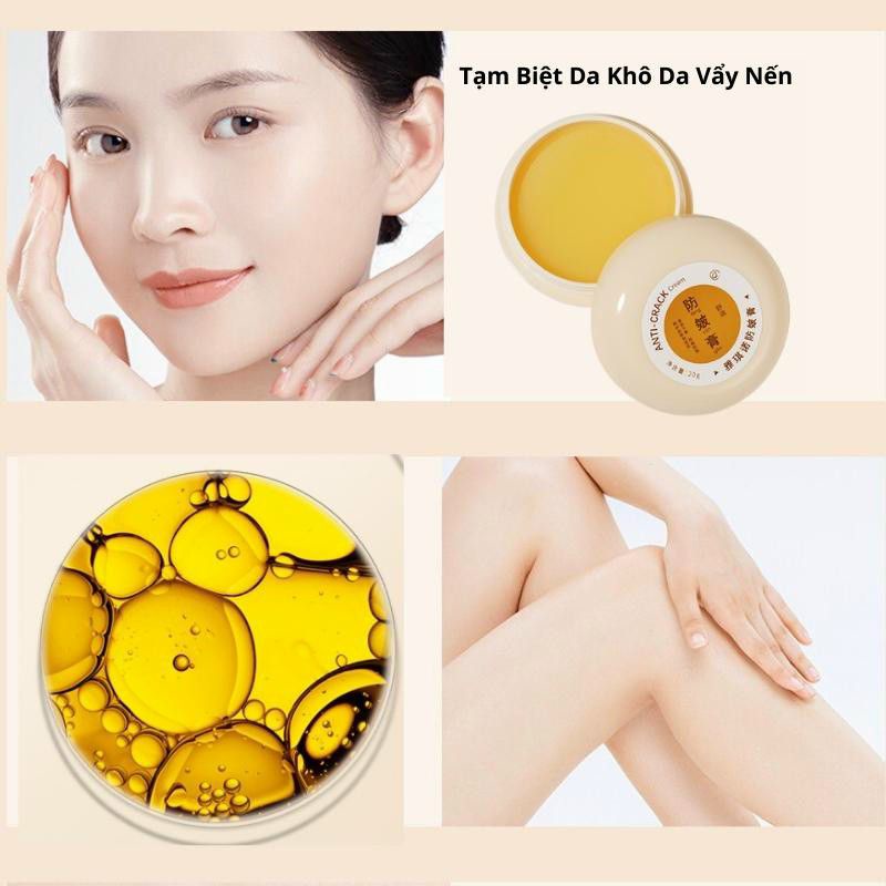 Kem nứt nẻ gót chân HEYXI làm mềm, dưỡng ẩm bàn chân, bàn tay, đầu gối và sạch da chết