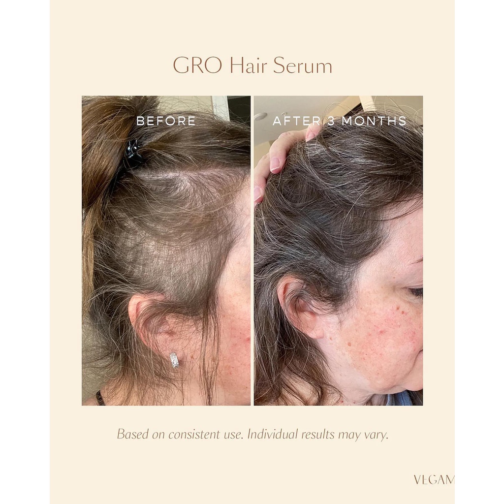 Serum, Gội - Xả kích thích mọc tóc Vegamour
