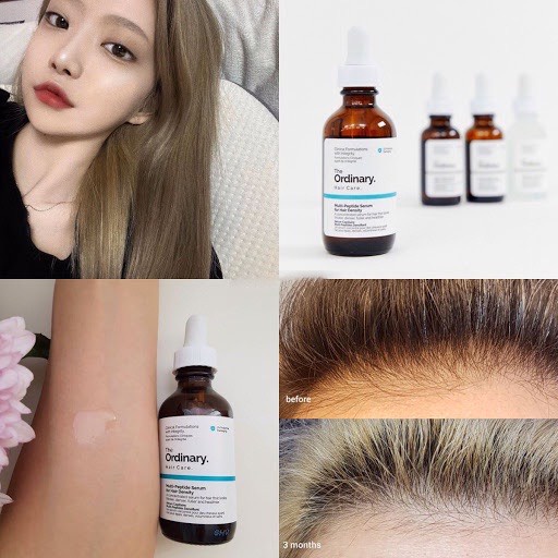 The Ordinary Serum dưỡng tóc, kích thích mọc tóc - The Ordinary Multi-Peptide Serum for Hair Density
