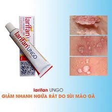 Hàng mới về] loại bỏ sùi mào gà, mụn cóc sinh dục với kem bôi larifan ungo
