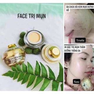 Combo giảm mụn mờ thâm huỳnh đỗ