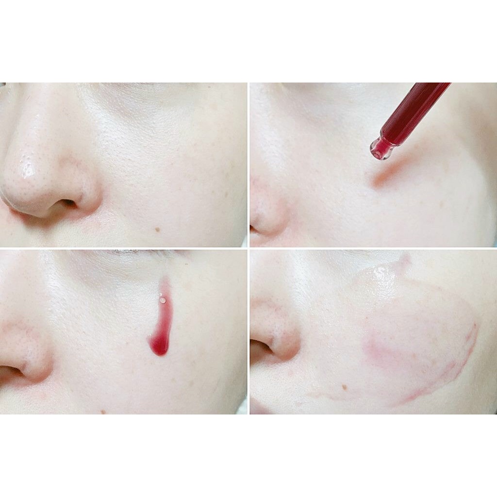 Tinh Chất Tái Tạo Da Red Peel Tingle Serum 35ml