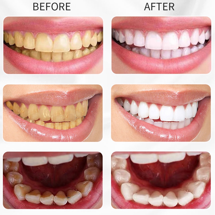 🦋giảm giá🦋Kem Làm Trắng Răng RtopR Mint tooth whitening 60ml Làm trắng răng, hơi thở tươi mát, giảm mảng bám răng