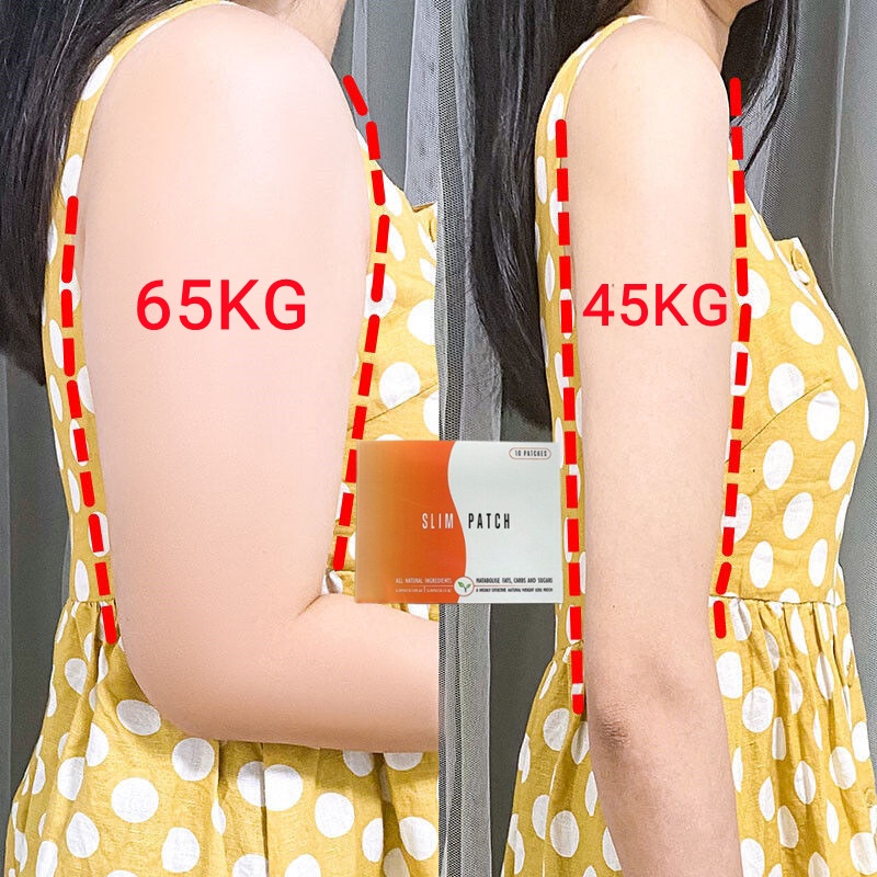 Miếng Dán Tan Mỡ Bụng Giảm Cân Nhanh Chóng