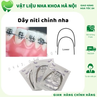 Dây cung niti chỉnh nha dây cung niềng răng - NHA KHOA HÀ NỘI
