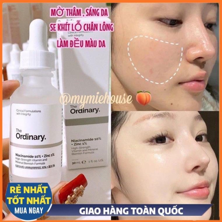 Serum Niacinamide 10% + Zinc 1% The Ordinary dưỡng trắng da số 1 thế giới /