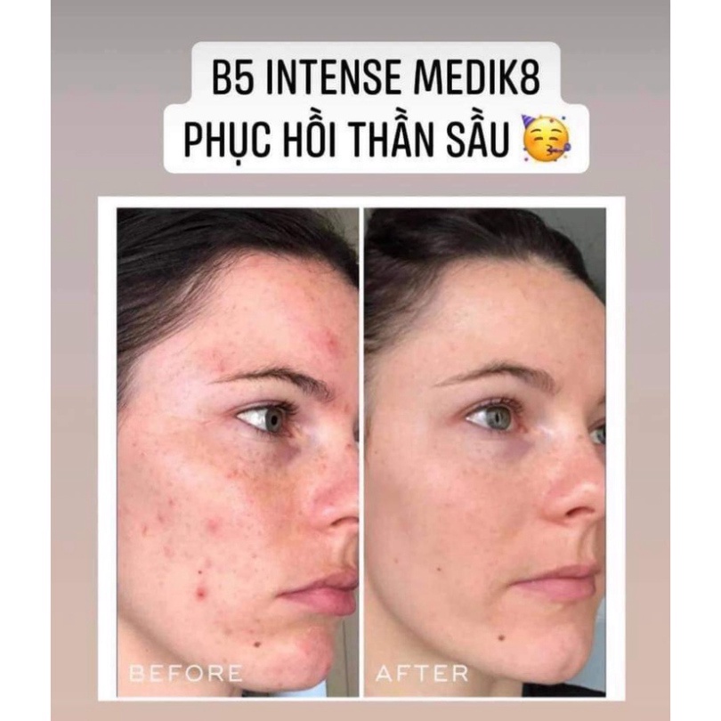 Tinh chất Serum siêu cấp ẩm và phục hồi da Medik8 Hydra8 B5 Serum 10ml, 30ml, 60ml