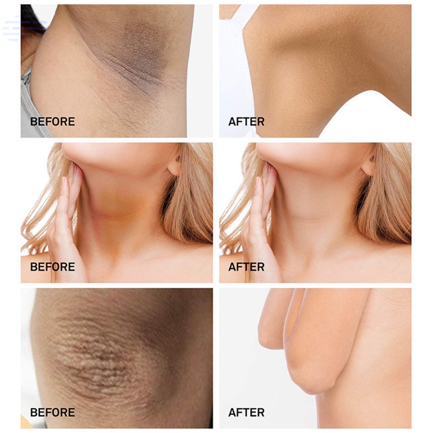 Kem làm trắng vùng da dưới cánh tay / đầu gối / toàn thân 50ml