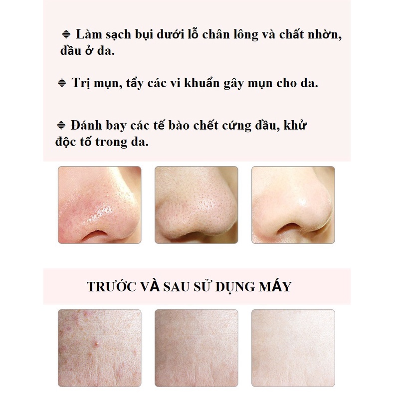 Máy hút mụn đầu đen CK- Máy Cà Da Chết Sủi Da dụng cụ làm sạch lỗ chân lông làm nóng giúp hút mụn cám, mụn đầu đen