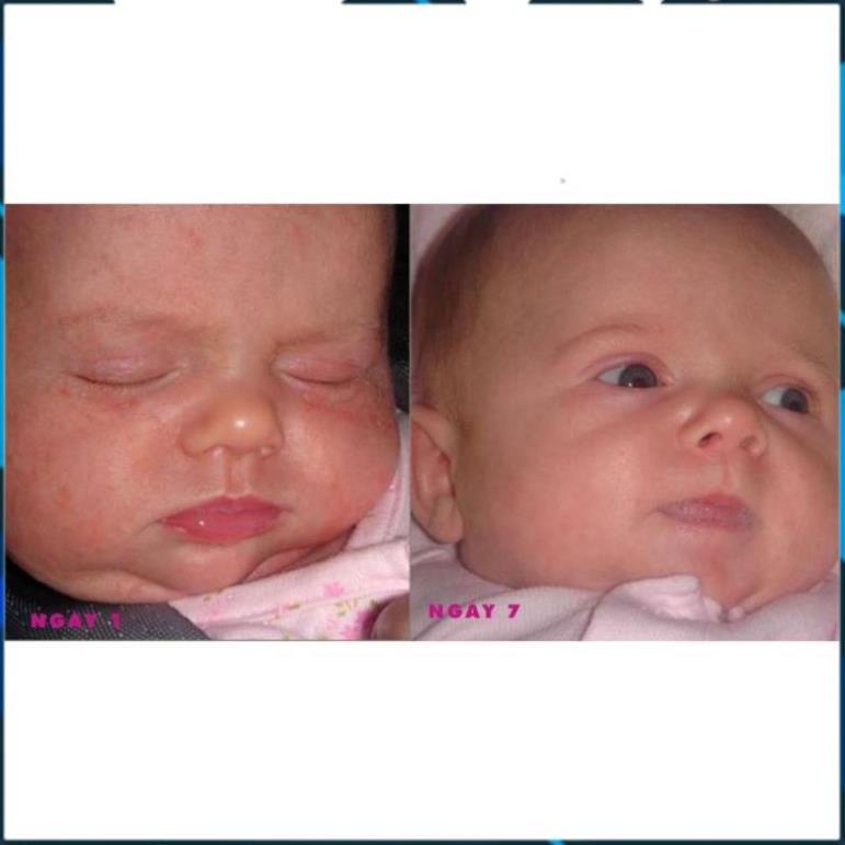 Kem Dưỡng Dexeryl Cream 50g 250g Pháp