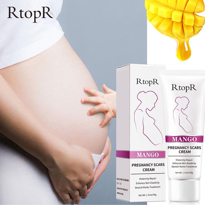 【💯Hàng thật】Kem dưỡng trị rạn da RtopR mango pregnancy scars cream 40g Dự phòng cho phụ nữ có thai, khắc phục rạn da