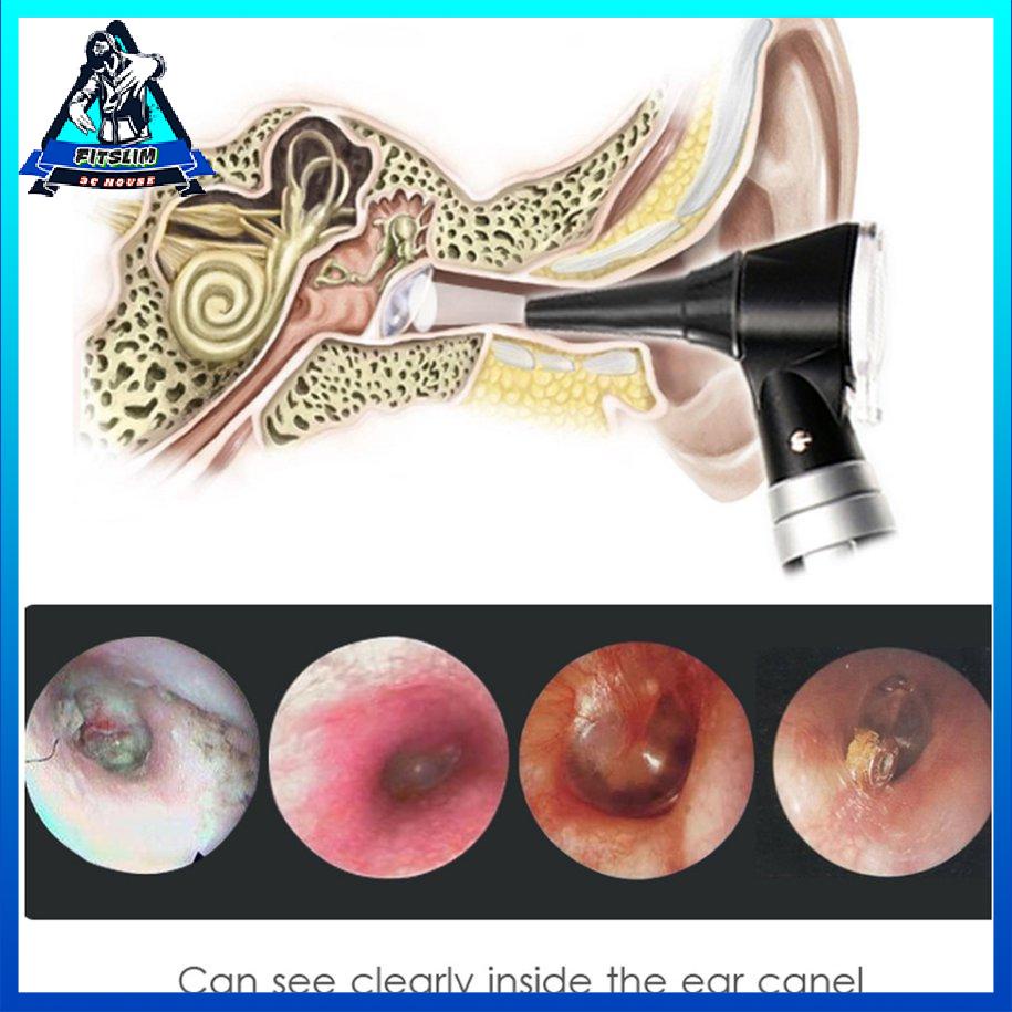 Bộ dụng cụ chẩn đoán Otoscopio chuyên nghiệp Máy nội soi chăm sóc tai y tế tại nhà [S/18]