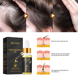 Tinh Dầu EELHOE Kích Thích Mọc Tóc Chống Rụng