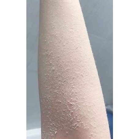 Kem Body Bong Da -  Tái Tạo Da Trắng Sáng dành cho da ngâm da đen chai lì, da không ăn kem, da thâm sạm