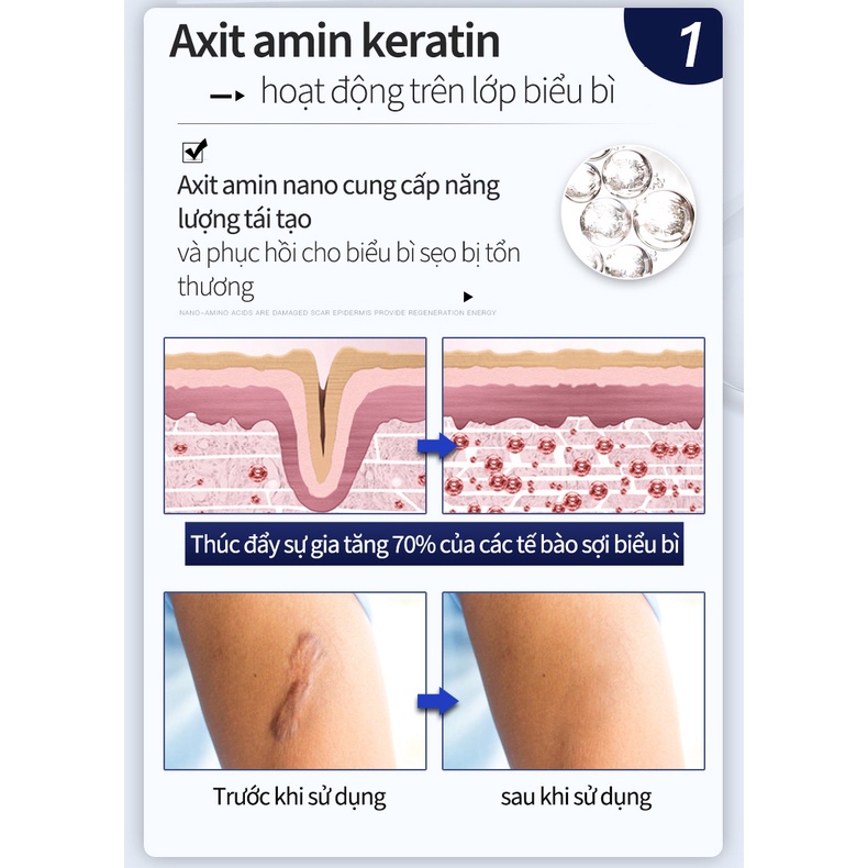 Kem Sẹo Kem xóa Sẹo Thâm Kem sẹo 50g Xóa sẹo thâm rạn da hiệu quả mờ thâm bỏng thương phẫu thuật