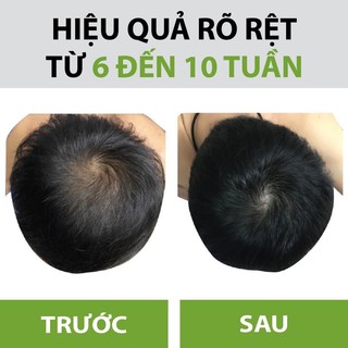Xịt Dưỡng Tóc Hoa Đà