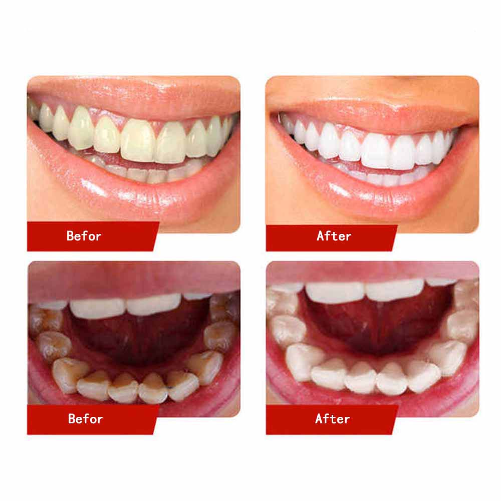 Smilekit Teeth Whitening V34 Colour Corrector, Toothpaste Against Sensitive Teeth and Gum Repair, Gum Health.Purple Toothpaste