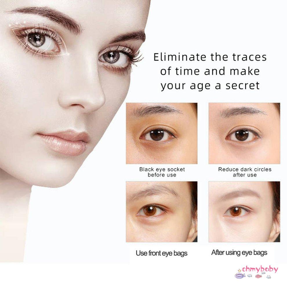 Máy mát xa mắt Ems Chống nhăn Thiết bị làm đẹp bằng điện [U/14]