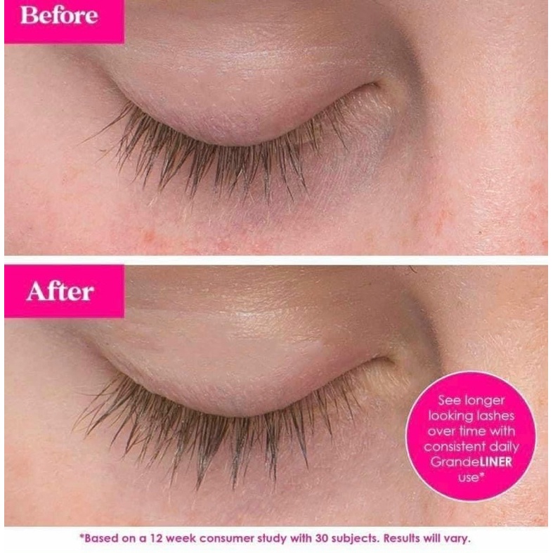 Kẻ Mắt Nước Chứa Serum Dưỡng Mi Grande Liner