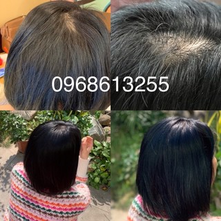 Xịt kích thích mọc tóc tinh chất sâm gừng