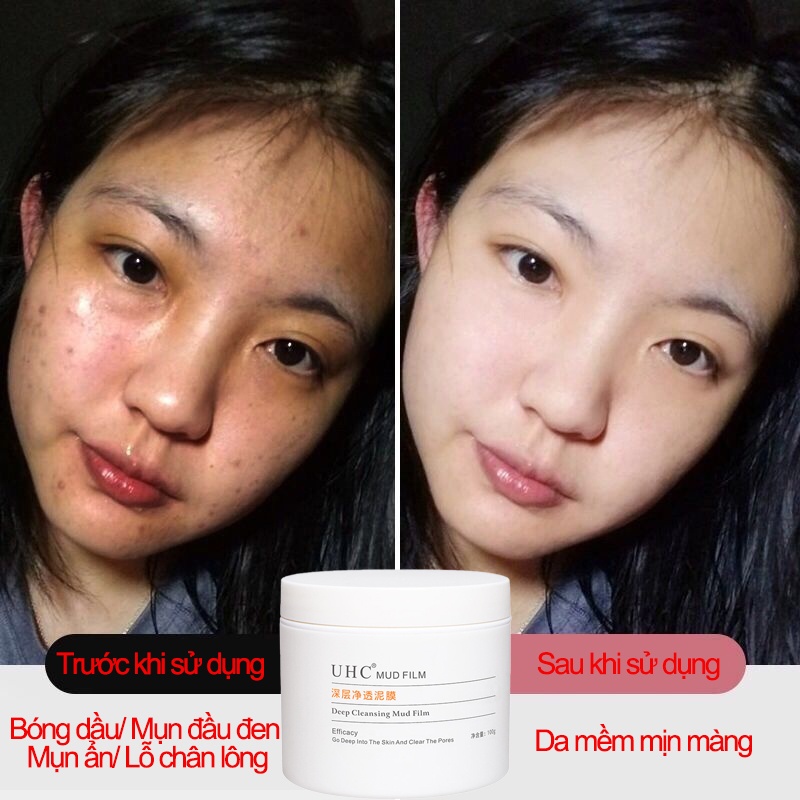 Mặt nạ Đất sét mặt nạ làm sạch giảm mụn đầu đen 100g làm sạch sâu se khít lỗ chân lông kiểm soát dầu dưỡng ẩm