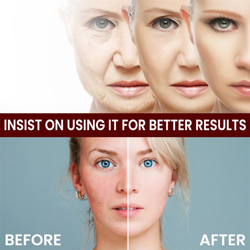 Kem dưỡng trắng da mặt JULYSTAR 30g tinh chất axit hyaluronic gạo trắng làm dịu da