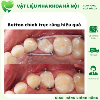Set 10 cái button chỉnh trục răng button chỉnh nha núm tròn chỉnh nha - nha khoa hà nội