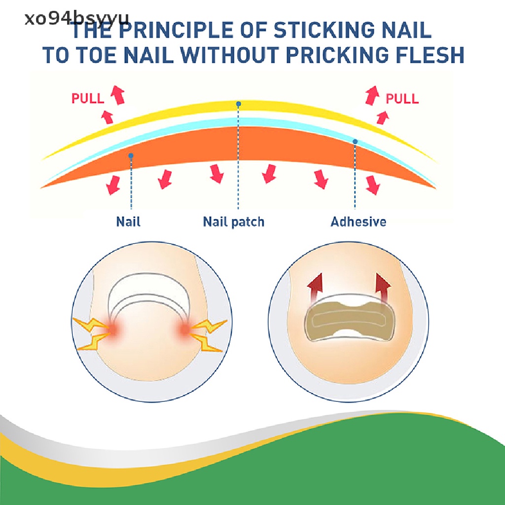 Set 50 Miếng Dán Chỉnh Sửa Móng Chân Xo94Bsyu Tiện Dụng