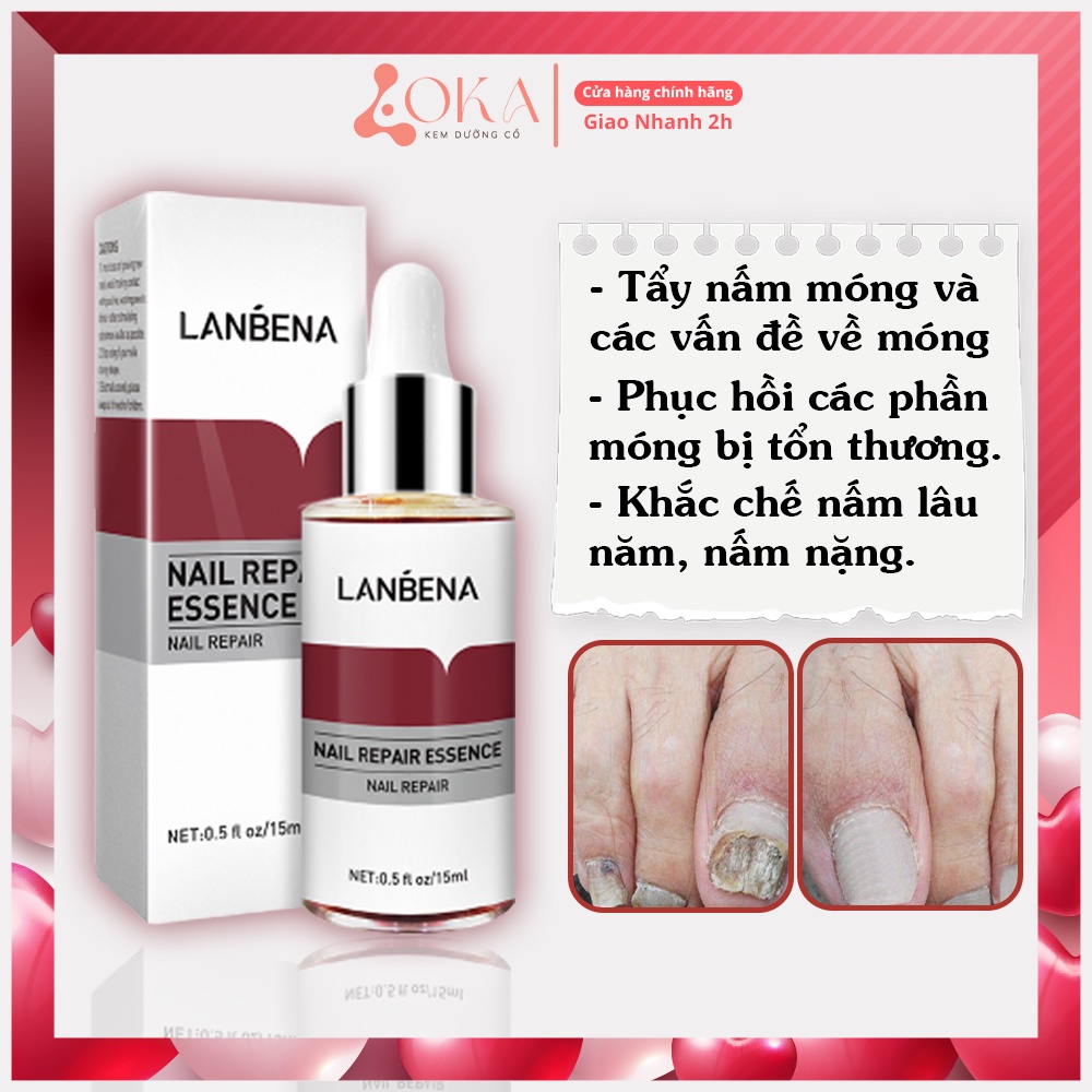 Serum phục hồi do nấm móng tay chân Lanbena an toàn hiệu quả