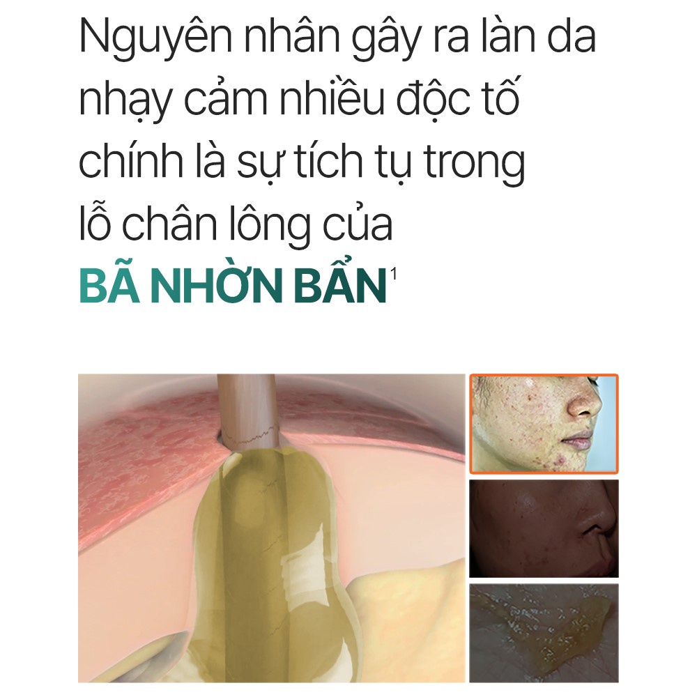 Sữa rửa mặt P.Calm UnderPore Foam Cleanser 150ml sạch sâu cho da