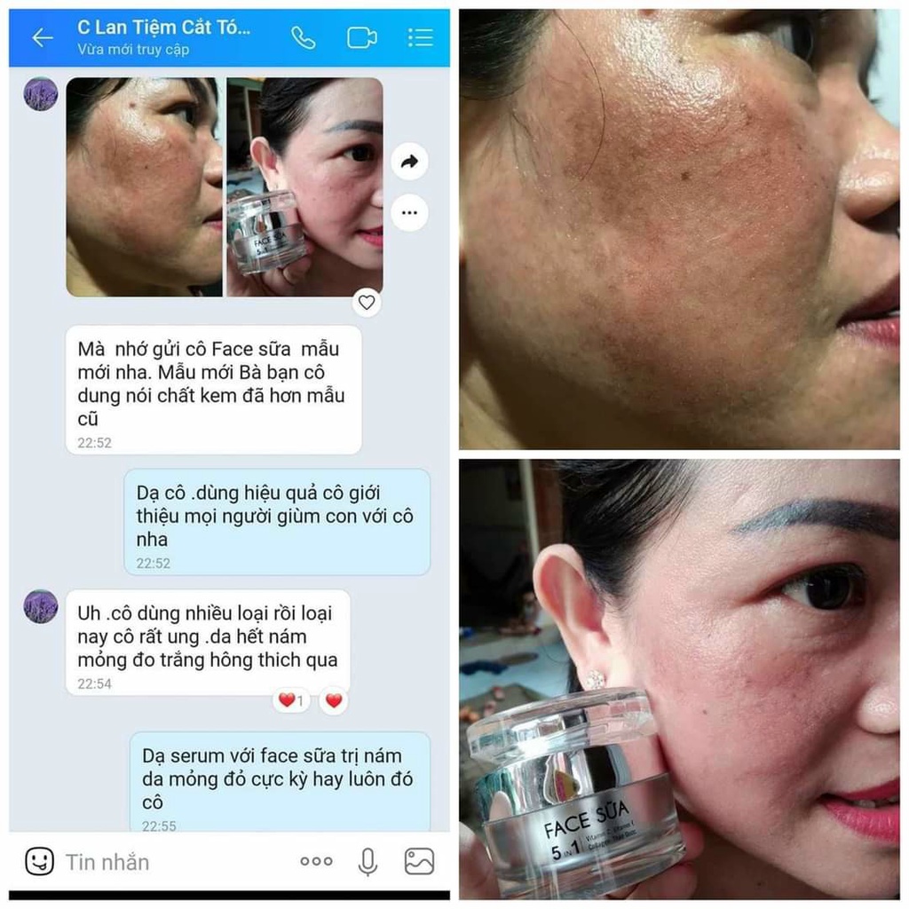 Chính hãng - Kem FACE SỮA 5in1 CÔ GÁI NÚI dưỡng trắng , giảm mụn , mờ thâm nám