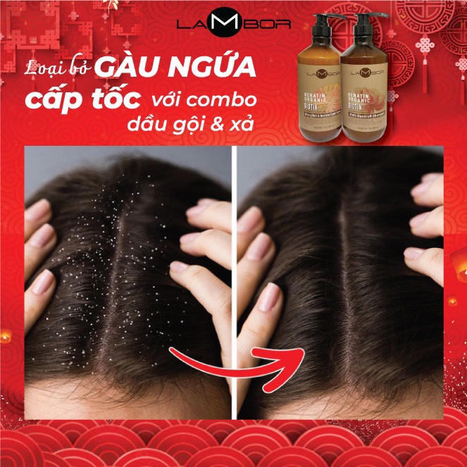 Dầu Gội Dầu Xả Keratin LAMBOR 1000ml * 2 Sạch Gàu Phục Hồi Kích Thích Mọc Tóc Thải Độc Da Đầu