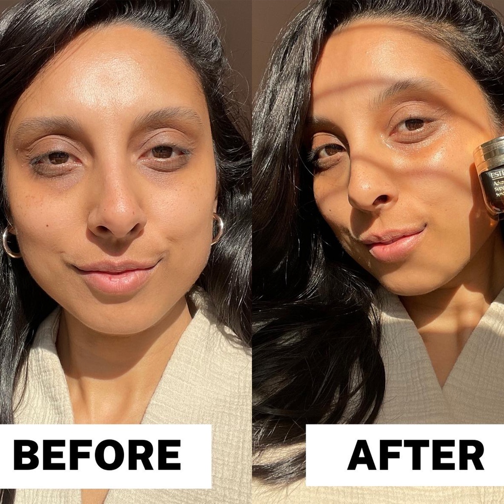 Kem Mắt Giảm Quầng Thâm, Nếp Nhăn Estee Lauder Advanced Night Repair Eye Supercharged Gel Cream