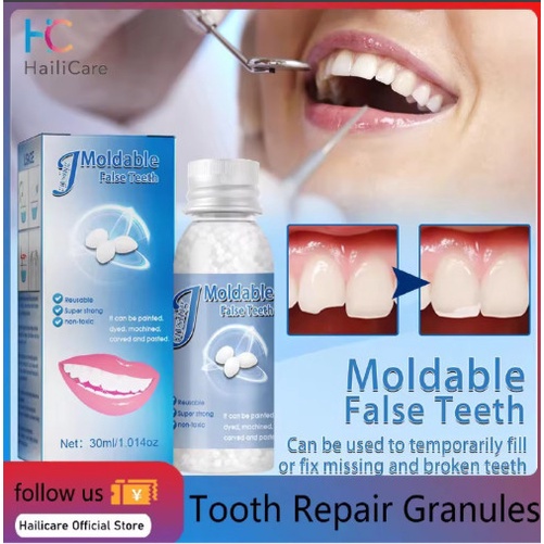 Miếng Dán Giả 30G Vật Liệu Trám Răng Có Thể Đúc Được Dụng Cụ Sửa Chữa Răng Tạm Thời Phục Hồi Răng Chắc C