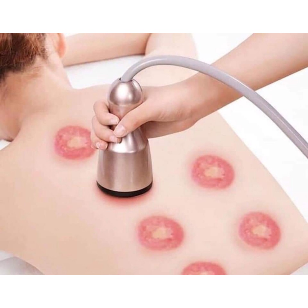 Máy cạo gió giác hơi, Máy Massage , đả thông kinh lạc