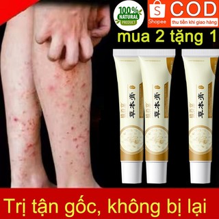 Kem bôi ngứa kem bôi hắc lào kem thảo dược tự nhiên kem kháng khuẩn 20g làm giảm nhiễm nấm và rêu da giảm ngứa