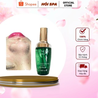 Ủ mụn đầu đen, mụn cám younger chính hãng dùng cho spa thẩm mỹ viện