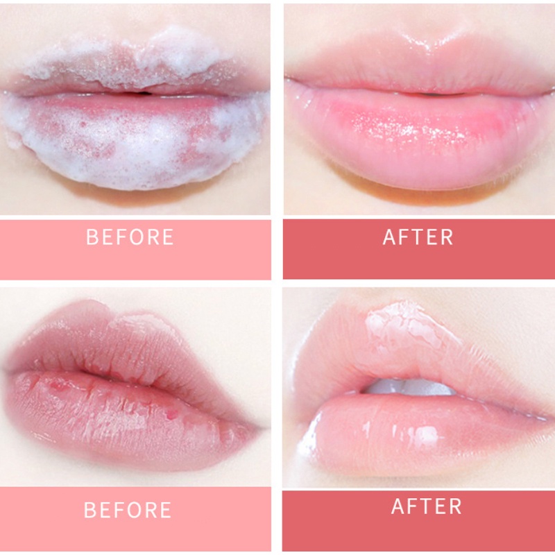 Mặt Nạ Môi Tẩy Tế Bào Chết Dưỡng Ẩm Làm Sáng Màu Da 7.5ml