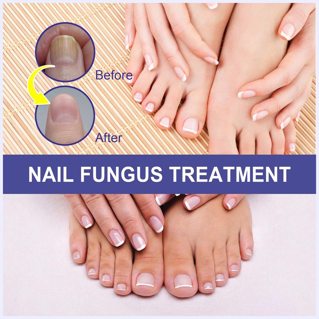 Tinh Chất Phục Hồi Móng Tay Bị Hư Tổn Và Chăm Sóc Móng