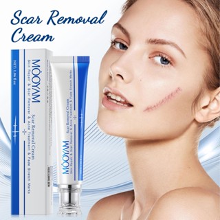 【💯Hàng thật Kem xóa sẹo MOOYAM Scar removing cream 30g Trị sẹo lõm trị sẹo lâu năm